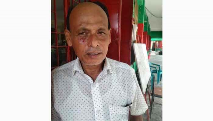 রাণীনগরে কমিটি গঠন নিয়ে শিক্ষকদের মধ্যে মারামারি দুই শিক্ষক আহত