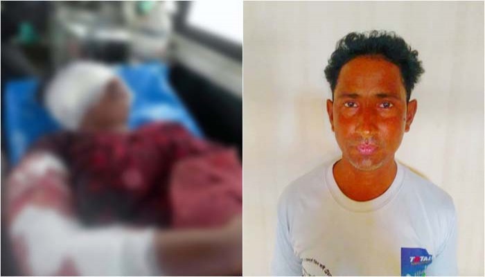 তাড়াশে নারীর নাক কাটলেন সাবেক স্বামী
