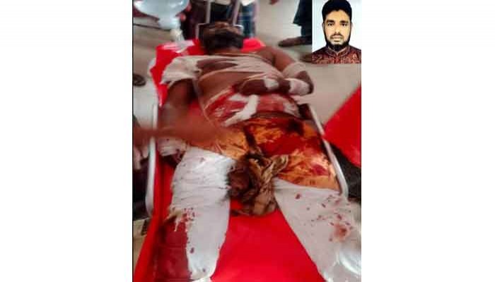 রাণীনগরে পরিষদের অফিস কক্ষে ঢুকে চেয়ারম্যানকে কুপিয়ে রক্তাক্ত জখম