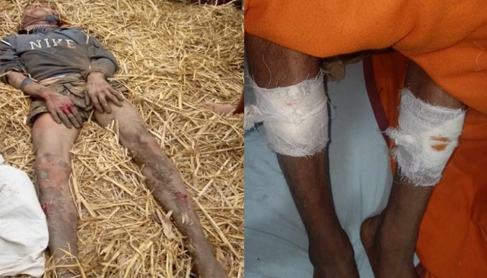 সাপাহারে দিবালোকে অসহায় কৃষক কৃষাণীকে জখমের অভিযোগ