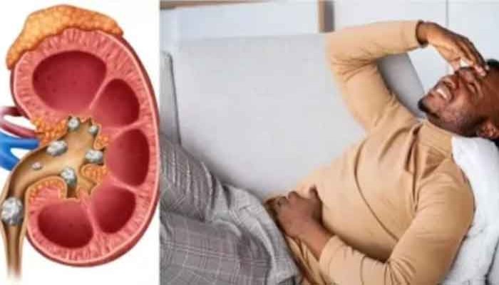 কিডনির জন্য বিষ এই সাদা জিনিস