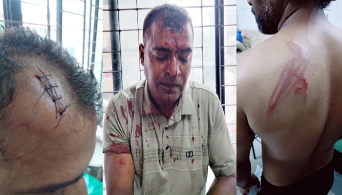 নওগাঁয় মারপিটের ঘটনায় থানায় এজাহার দিয়েও মিলেনি কোন প্রতিকার