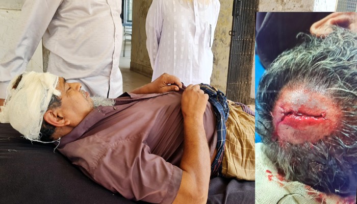 গুরুদাসপুরে পুকুর লিজের টাকা চাওয়ায় ভাইকে কুপিয়ে জখম