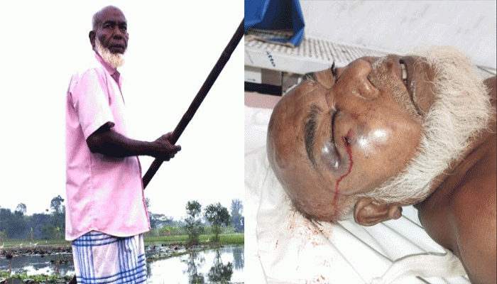 নোয়াখালীতে গাছের ঢাল কাটাকে কেন্দ্র করে বৃদ্ধাকে পিটিয়ে হত্যার অভিযোগ