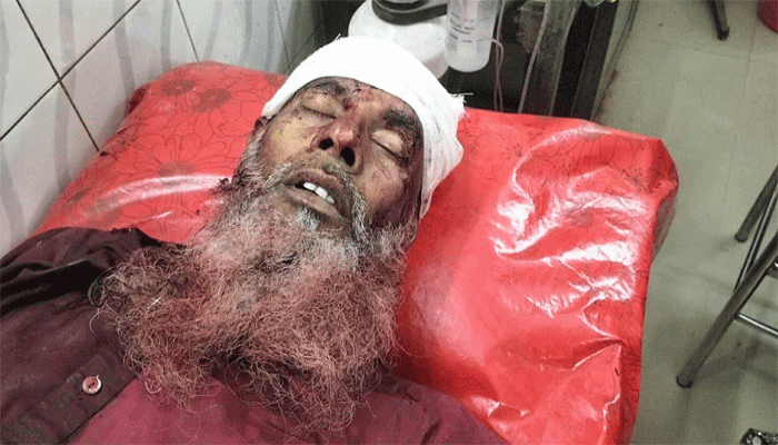 নিয়ামতপুরে ভাতিজার হাঁসুয়ার কোপে চাচা খুন