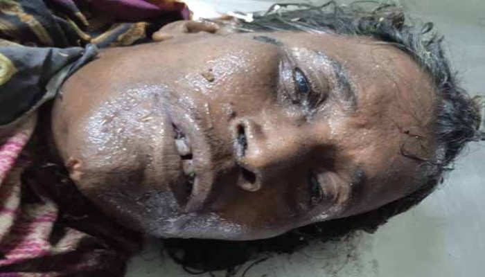 নগরীর বিনোদপুরে অজ্ঞাত মৃত নারীর সন্ধান চায় মতিহার থানা পুলিশ নগরীর বিনোদপুরে অজ্ঞাত মৃত নারীর সন্ধান চায় মতিহার থানা পুলিশ