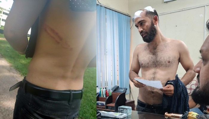 কোম্পানীগঞ্জে বাসে বেশি ভাড়া নেওয়ার প্রতিবাদ করায় মাথা ফাটালো যাত্রীর