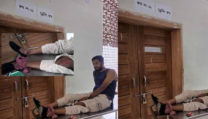 রামেকের জরুরী বিভাগে আহত সাংবাদিক রুমেল; ডেসিং রুমে ঝুলছিল তালা! রামেকের জরুরী বিভাগে আহত সাংবাদিক রুমেল; ডেসিং রুমে ঝুলছিল তালা!