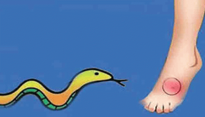 নোয়াখালীতে সাপের কামড়ে শিশুর মৃত্যু নোয়াখালীতে সাপের কামড়ে শিশুর মৃত্যু