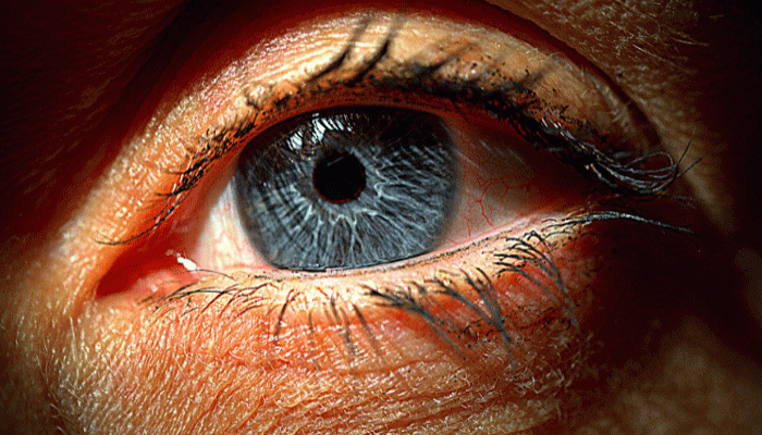 বদনজর কি সত্য, নবীজি যা বলেছেন