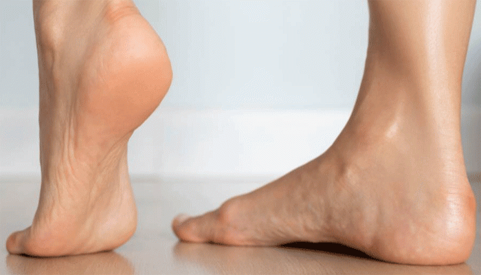 গোড়ালি নরম এবং মসৃণ হবে ঘরোয়া পদ্ধতিতেই গোড়ালি নরম এবং মসৃণ হবে ঘরোয়া পদ্ধতিতেই