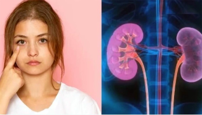 নিঃশব্দে কিডনি ঝাঁঝরা হওয়ার আগে বিপদ সংকেত দেয় চোখ! নিঃশব্দে কিডনি ঝাঁঝরা হওয়ার আগে বিপদ সংকেত দেয় চোখ!