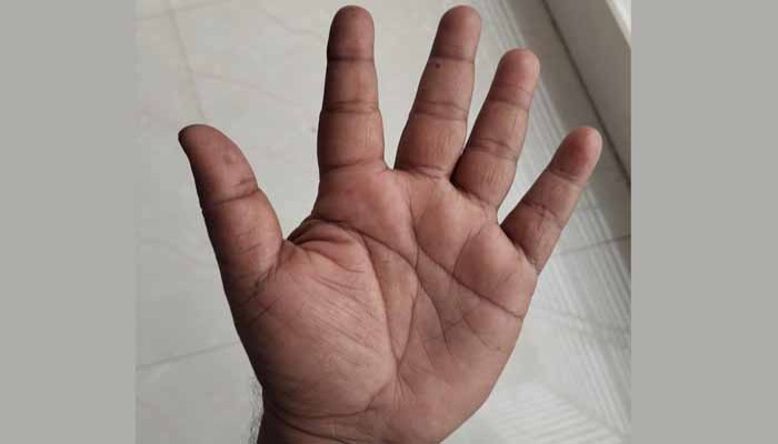 আপনার হাতে যদি M চিহ্ন থাকে তাহলে যা আছে ভাগ্যে