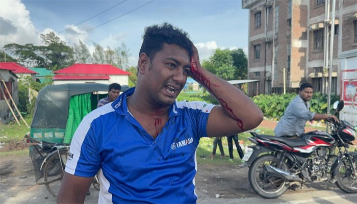 কোম্পানীগঞ্জে একই স্থানে বিএনপির দুই গ্রুপের কর্মসূচি, সড়ক অবরোধ, আহত-৪ কোম্পানীগঞ্জে একই স্থানে বিএনপির দুই গ্রুপের কর্মসূচি, সড়ক অবরোধ, আহত-৪