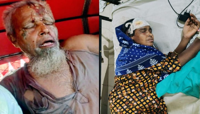 রাণীনগরে বিবাদমান জমি নিয়ে দু-পক্ষের মারামারি আহত - ৩