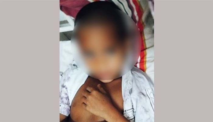 খতনার সময় শিশুর অঙ্গ কেটে পকেটে নিয়ে পালালেন বেদে