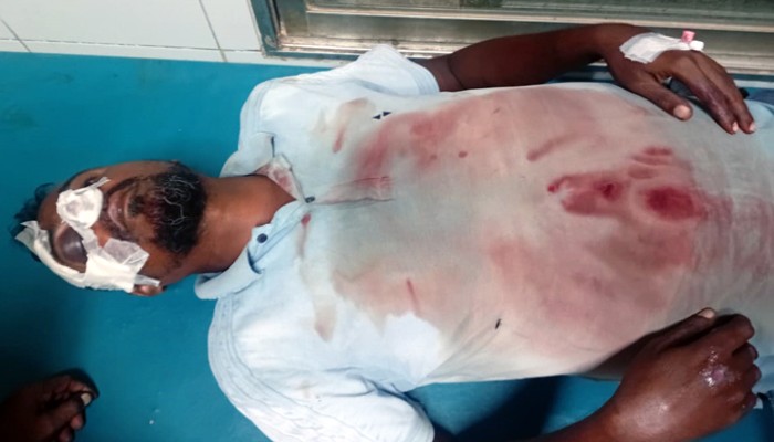 রাজশাহীতে ব্যবসায়ীকে আহত করে সাড়ে ১২লাখ টাকা ও মোটরসাইকেল ছিনতাইয়ের অভিযোগ রাজশাহীতে ব্যবসায়ীকে আহত করে সাড়ে ১২লাখ টাকা ও মোটরসাইকেল ছিনতাইয়ের অভিযোগ