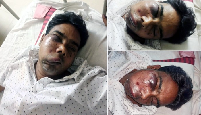 হরিরামপুরে বিএনপি'র অভ্যন্তরীণ কোন্দলে যুবদল নেতাকে মারধরের অভিযোগ হরিরামপুরে বিএনপি'র অভ্যন্তরীণ কোন্দলে যুবদল নেতাকে মারধরের অভিযোগ