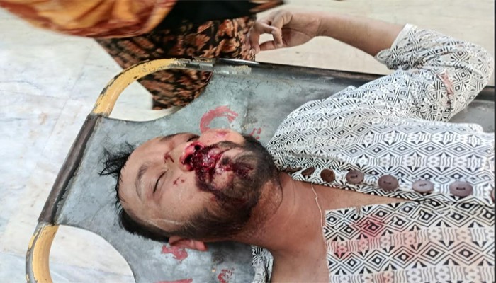 নগরীর মোন্নাফের মোড়ে যুবককে পিটিয়ে জখম, থানায় অভিযোগ নগরীর মোন্নাফের মোড়ে যুবককে পিটিয়ে জখম, থানায় অভিযোগ