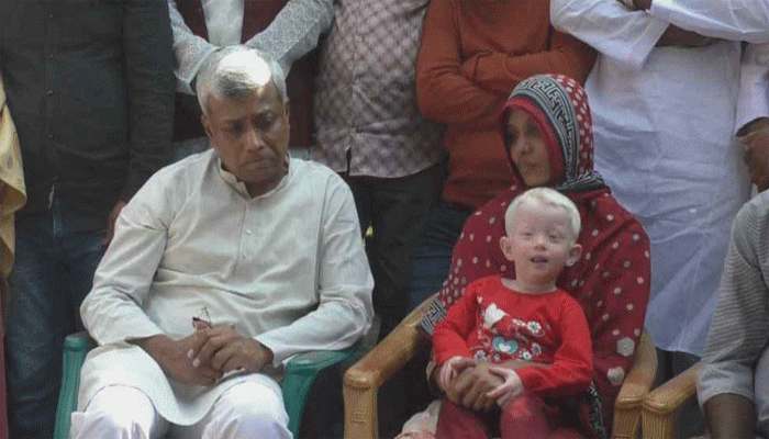 ‘অতি ফর্সা’ শিশুটির পাশে দাঁড়ালেন তারেক রহমান