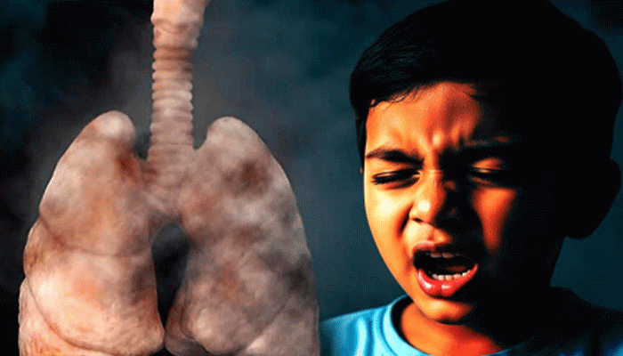 শীতে ফুসফুসের রোগ বাড়ছে, সুস্থ থাকার উপায়