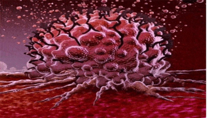 একটি প্রোটিনের কারণেই ক্যানসারের এত বাড়বাড়ন্ত, খুঁজে পেয়ে জব্দ করার উপায় বার করলেন গবেষকেরা