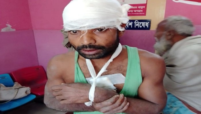 নোয়াখালীতে কৃষকের হাত ভেঙে কুপিয়ে জখম