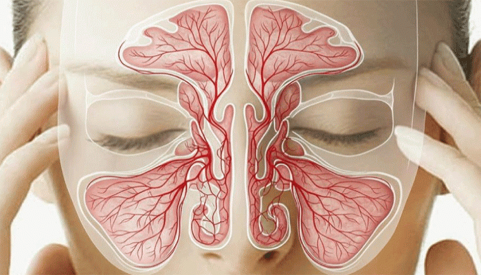 শীতে সাইনাসের সমস্যায় কষ্ট পাচ্ছেন, ঘরোয়া প্রতিকারেই বশে রাখুন ব্যথা