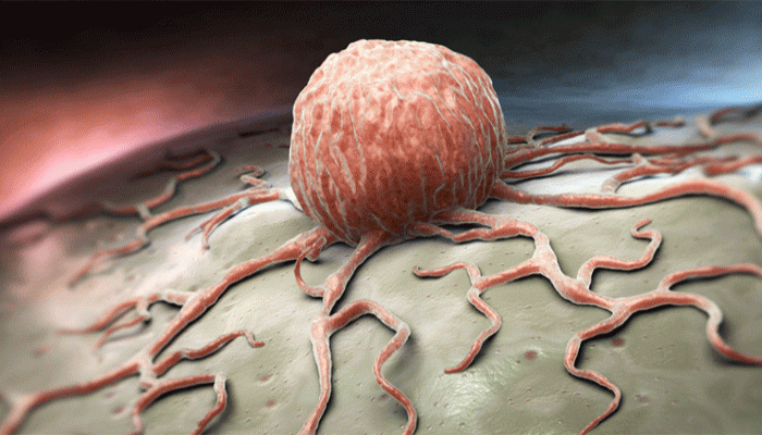 ক্যানসারের ঝুঁকি কমাতে পারে ৬ খাবার