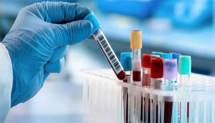 ডোপ টেস্ট ‘পজিটিভ’ হলে হবে না সরকারি চাকরি, বিধিমালা জারি