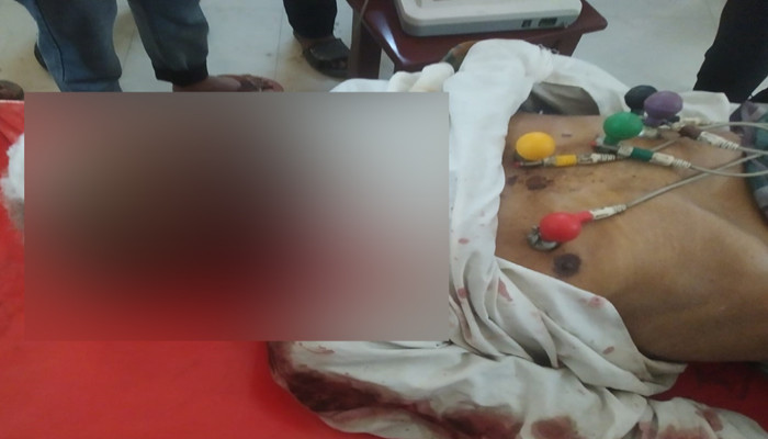 ঠাকুরগাঁওয়ে সড়কে ঝরে গেল এক নীরব জীবনের শেষ প্রদীপ