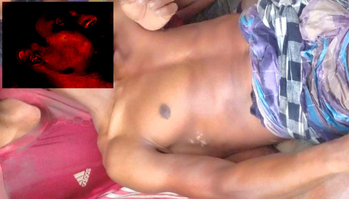 মান্দায় বজ্রপাতে কৃষিশ্রমিকের মৃত্যু, আহত ১