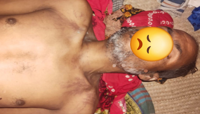 ধান রোপণের সময় বজ্রপাতে শ্রমিকের মৃত্যু