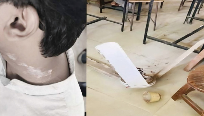 রুয়েটে শ্রেণিকক্ষে সিলিং ফ্যান পড়ে শিক্ষার্থী আহত