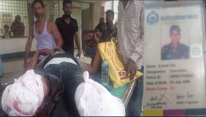 আত্রাই চলন্ত ট্রেন থেকে নামতে গিয়ে পুলিশ সদস্যের ২ পা বিচ্ছিন্ন