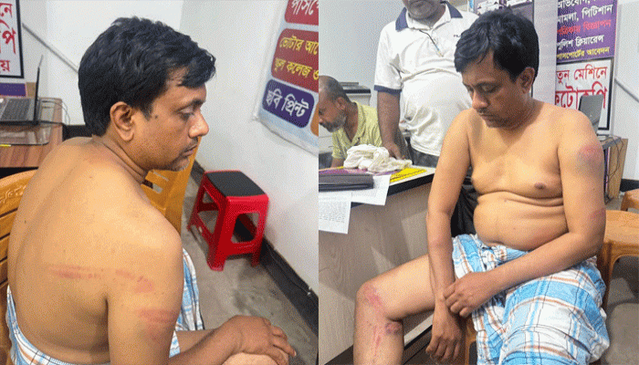 মাটি কাটায় প্রতিবাদ করায় বিএনপি নেতার ওপর হামলা, থানায় মামলা