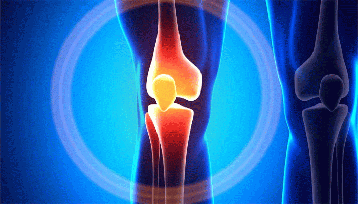 অস্থিসন্ধির ব্যথায় ভুগছেন, শুধু জুতো নয় কোন অভ্যাস বদলে ফেলা দরকার?