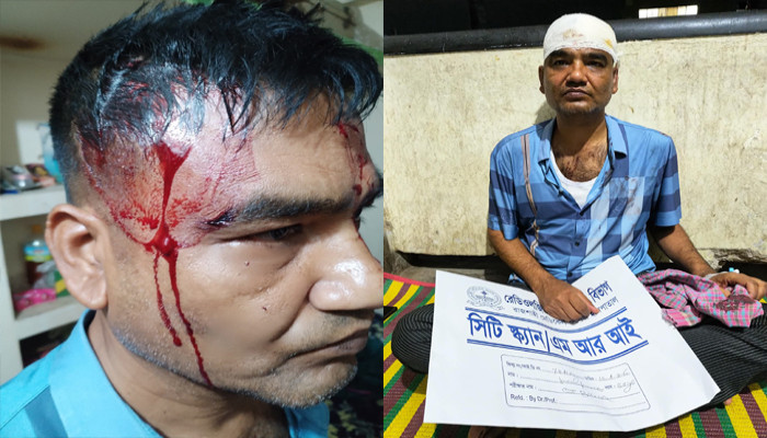 নগরীতে এসআইকে পিটিয়ে জখমের অভিযোগ, হাসপাতালে চিকিৎসাধীন