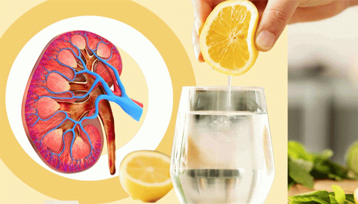 নিয়ম করে লেবুর জল খেলে কি কিডনিতে পাথর হওয়ার ঝুঁকি কমতে পারে?