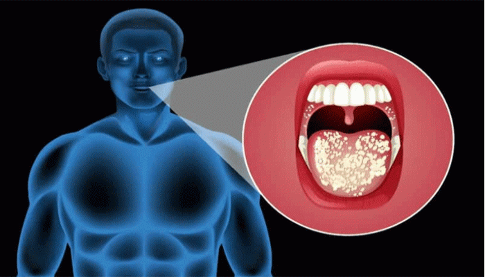 মুখের ক্যানসার! নেপথ্যে রয়েছে আরও ৪ কারণ