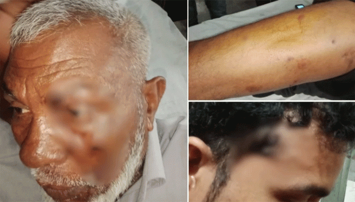 পদ্মা নদীতে টহলরত নৌ পুলিশের ওপর হামলা, ওসিসহ ৫ সদস্য গুলিবিদ্ধ