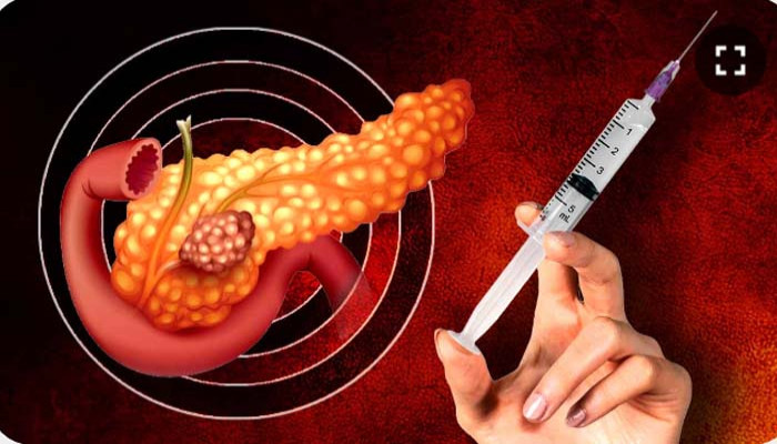 অগ্ন্যাশয়ের ক্যানসারেও বেশি দিন বাঁচবেন রোগী, আশার আলো দেখাচ্ছে নতুন ‘এমআরএনএ’ টিকা