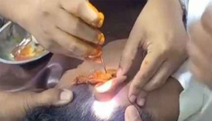 পুলিশের ভয়ে কানের ভেতর ইয়াবা ঢুকিয়ে ফেলেন নিরব