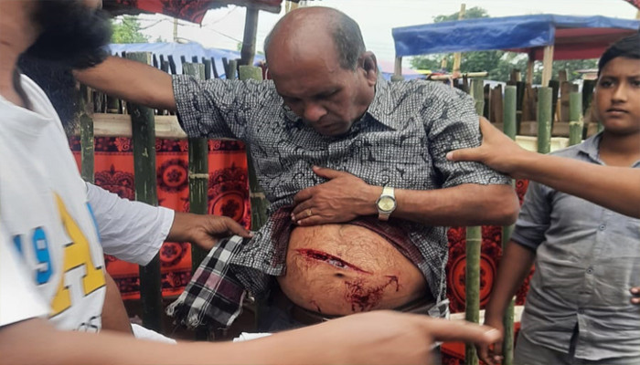 সান্তাহারে জায়গা বিরোধে বিএনপি নেতা ইকবাল হোসেনকে কুপিয়ে আহত