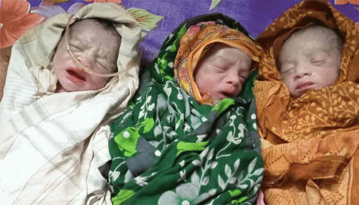 লালপুরে একসঙ্গে তিন পুত্রসন্তানের জন্ম, আনন্দের সাথে দুশ্চিন্তা