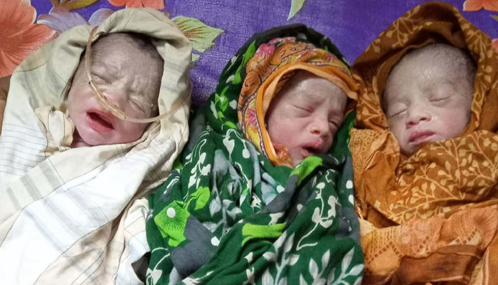 লালপুরে একসঙ্গে ৩ যমজ পুত্র সন্তানের জন্ম দিলেন সুরাইয়া খাতুন