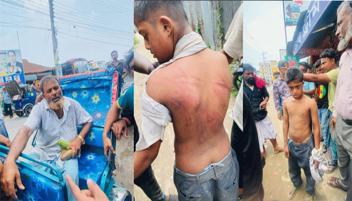 দুটি আমের জন্য শিশুকে অমানবিক নির্যাতন