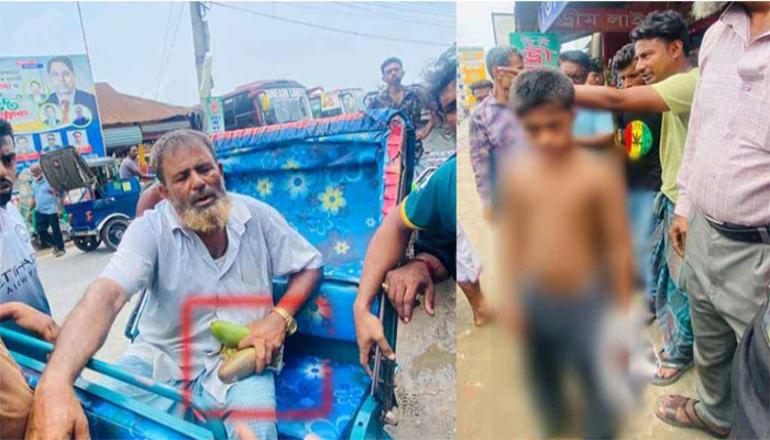 দুটি আমের জন্য মানসিক ভারসাম্যহীন শিশুকে ‘নির্মম’ নির্যাতন