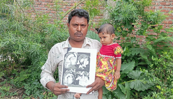 হৃদপিণ্ডে ছিদ্র ও খাদ্যনালী ব্লকে মৃত্যুর সাথে লড়ছে ১৩ মাসের অর্পিতা- বাঁচাতে এগিয়ে আসার আকুল আহ্বান