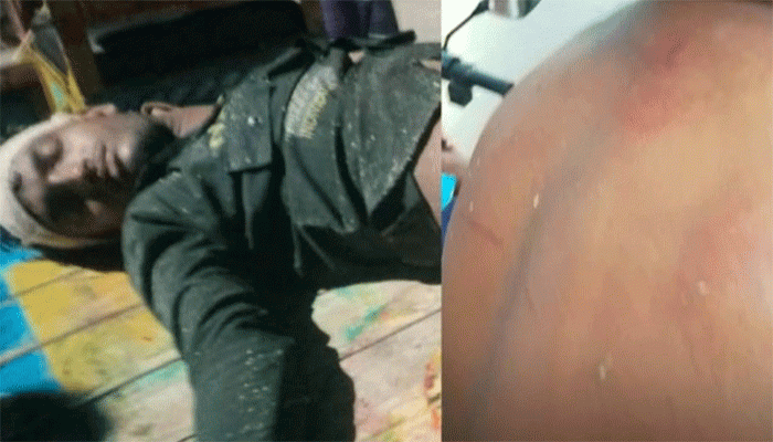 তানোরে যুবককে হাতুড়িপেটা করে নালায় নিক্ষেপ!